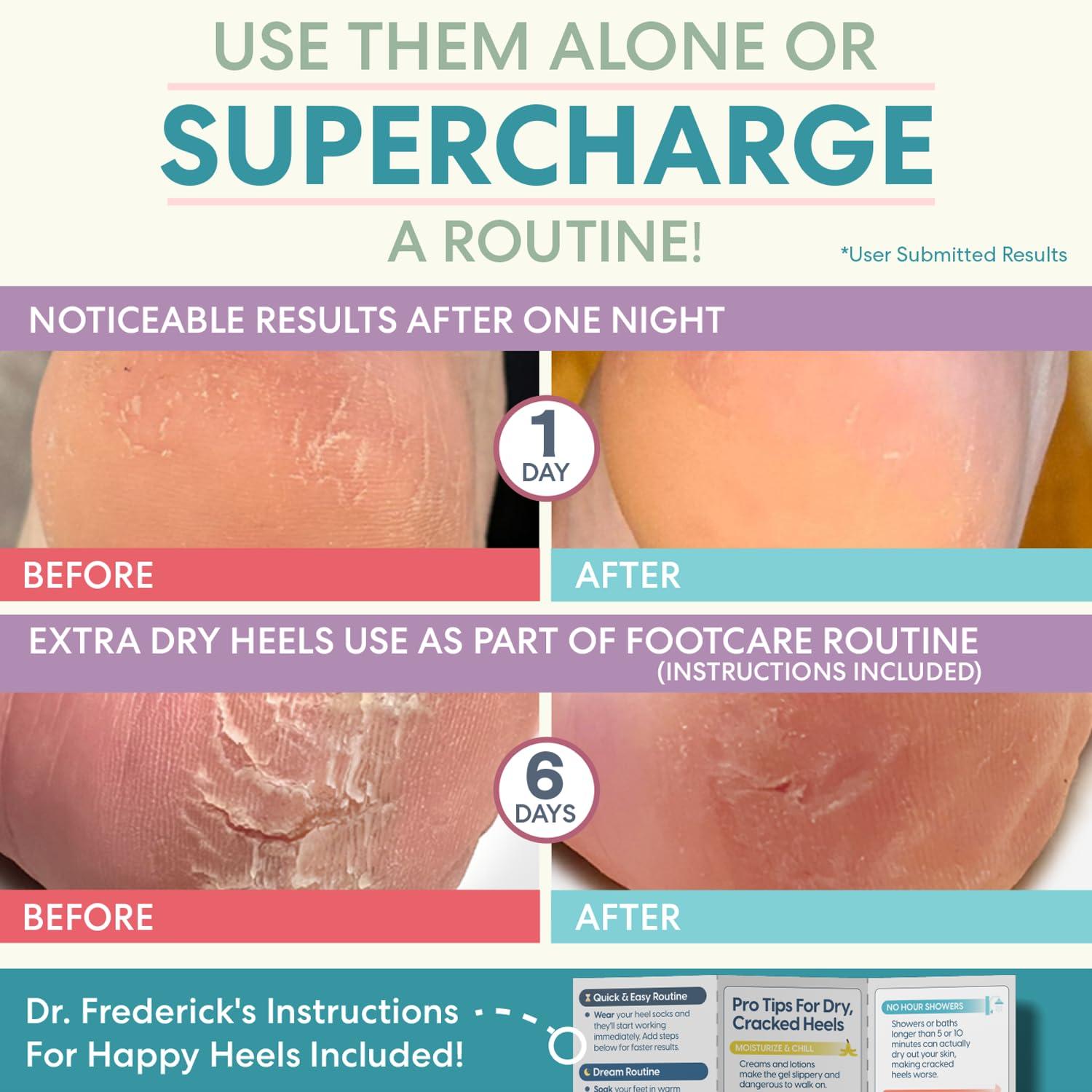 Dr. Frederick\'s Original Dr. Frederick\'s Original Moisturizing Heel Socks For Cracked Heel Treatment - 2 Pairs - Stop Cracked Heels In Their Tracks, Grey