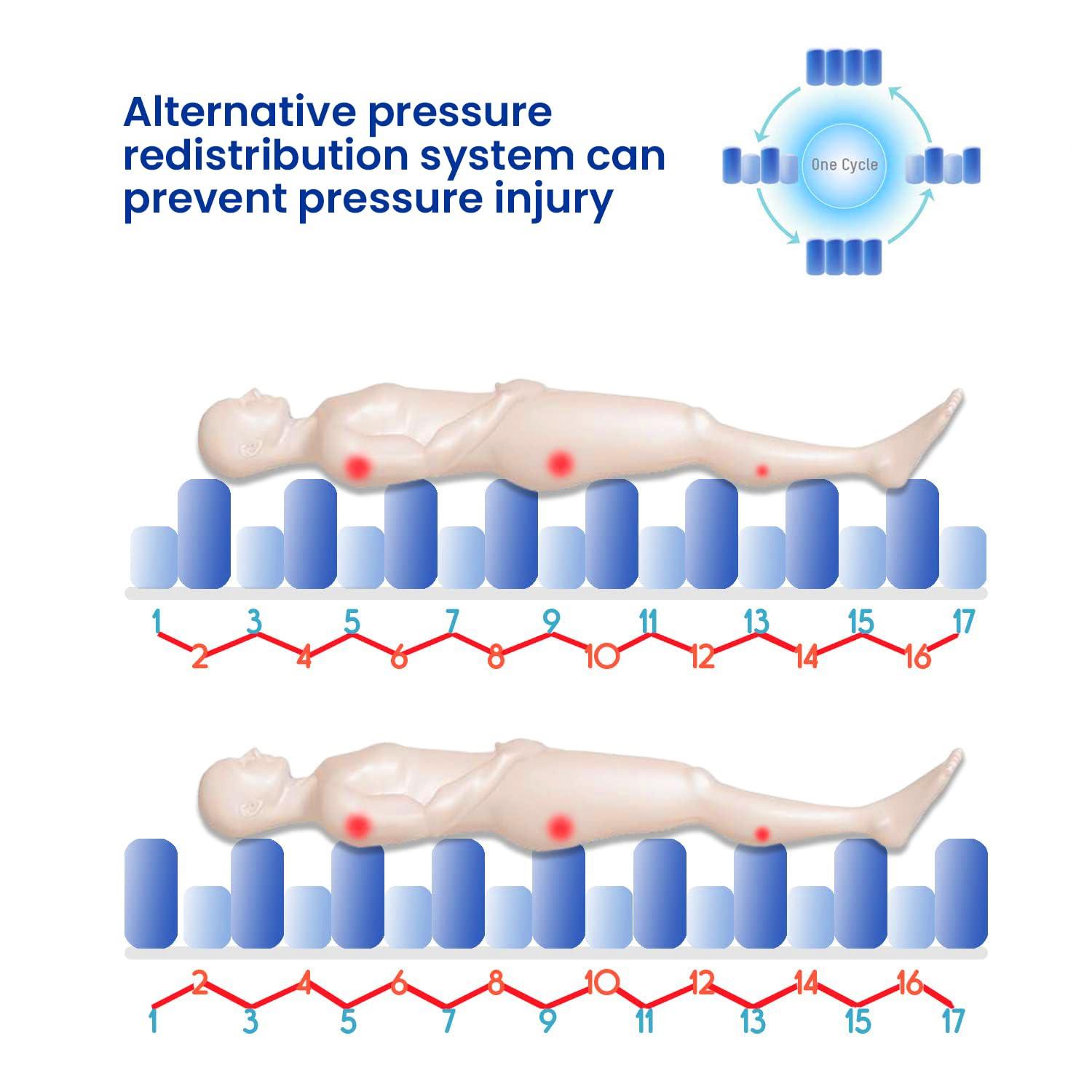 PARAMOUNT INCOFIT Paramount ARO Care Anti Decubitus Bubble Air Mattress for Patients Bed Sore with Pump | Anti Bedsore Anti-Decubitus Mattress Pad, Inflatable Air Bed | Bubble Mattress- 1 Year Warranty