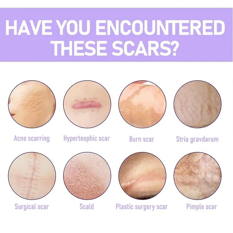 Bioline Bioline Clear Silicon Scar Sheet 4 x 150 Cm for Healing Scars Transparent tear silicone tape roll for hypertrophic scars and keloids caused by surgery, medical silicone for scar removal