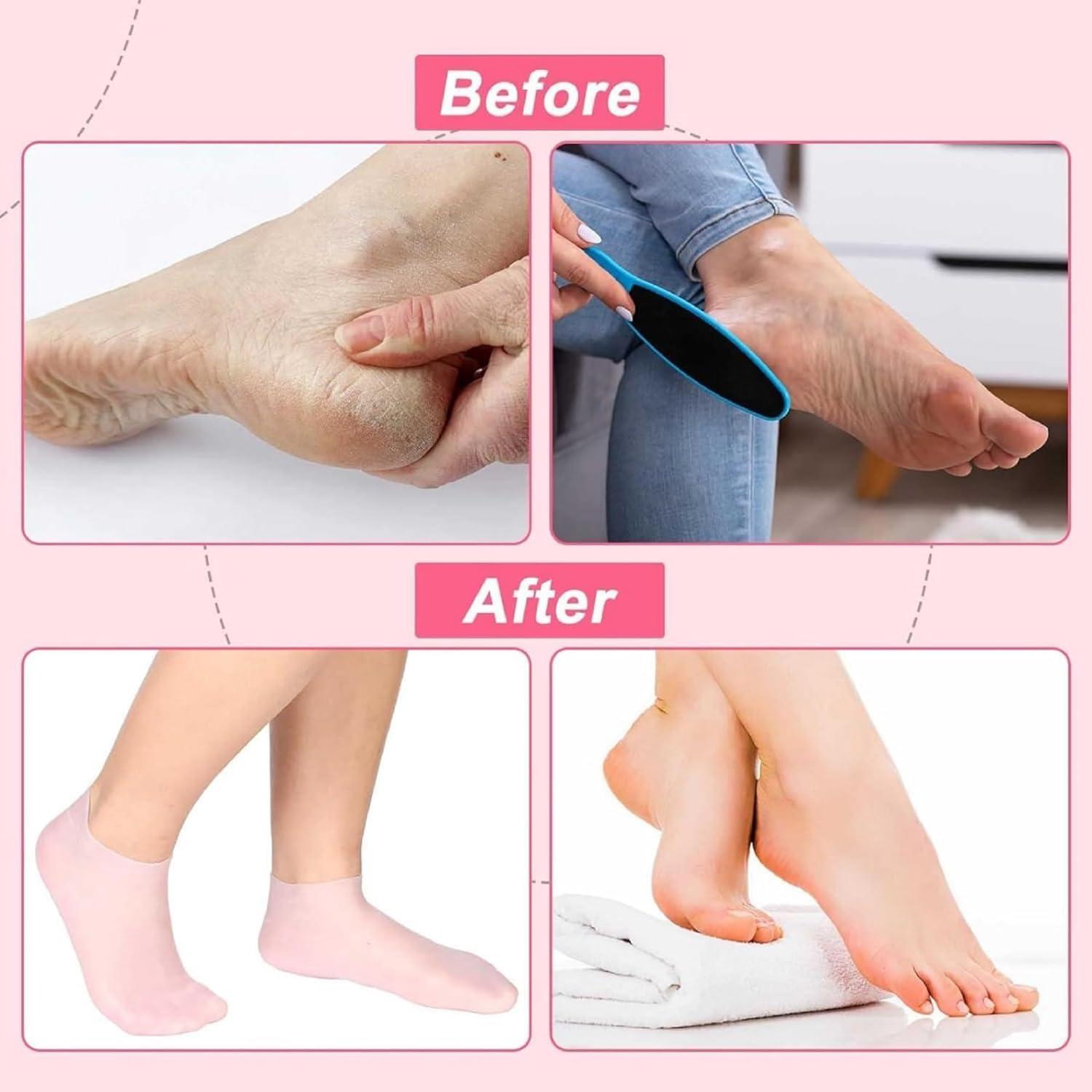 Zorzel Zorzel Silicone Moisturizing Socks for Women Dry Cracked Feet, Soft Gel Rubber Socks, Women Foot Care Spa Pedicure Silicone Socks for Cracked Heel and Softening Rough Skin - (1 Pair)