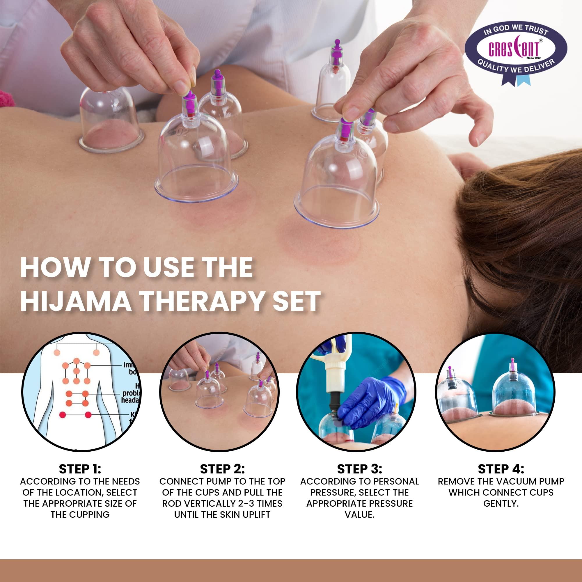 CRESCENT Crescent Hijama Set| Cupping Therapy Kit| Hijama Cupping Set with Pump and 6 Cups (1 Pair, Size 1-6), 1 Black Pump