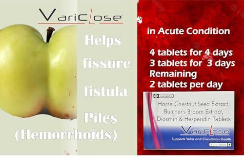VARICLOSE Variclose Support Varicose Veins, Spider veins | Diosmin, Hesperidin, Horse Chestnut extract (Aescin), Butchers broom extract (Ruscogenins) | Plant based Foot, Legs Vascular Micro Circulation Support Supplement -60 Tablets