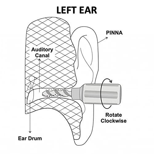 MCIPL ear’O’clean Ear Cleaner And Ear Wax Remover / Ear Scratcher (Multicolour) - Pack of 6 | Reusable ear cleaner made of very soft material to avoid injury while cleaning | Can be used as an ear-scratchin