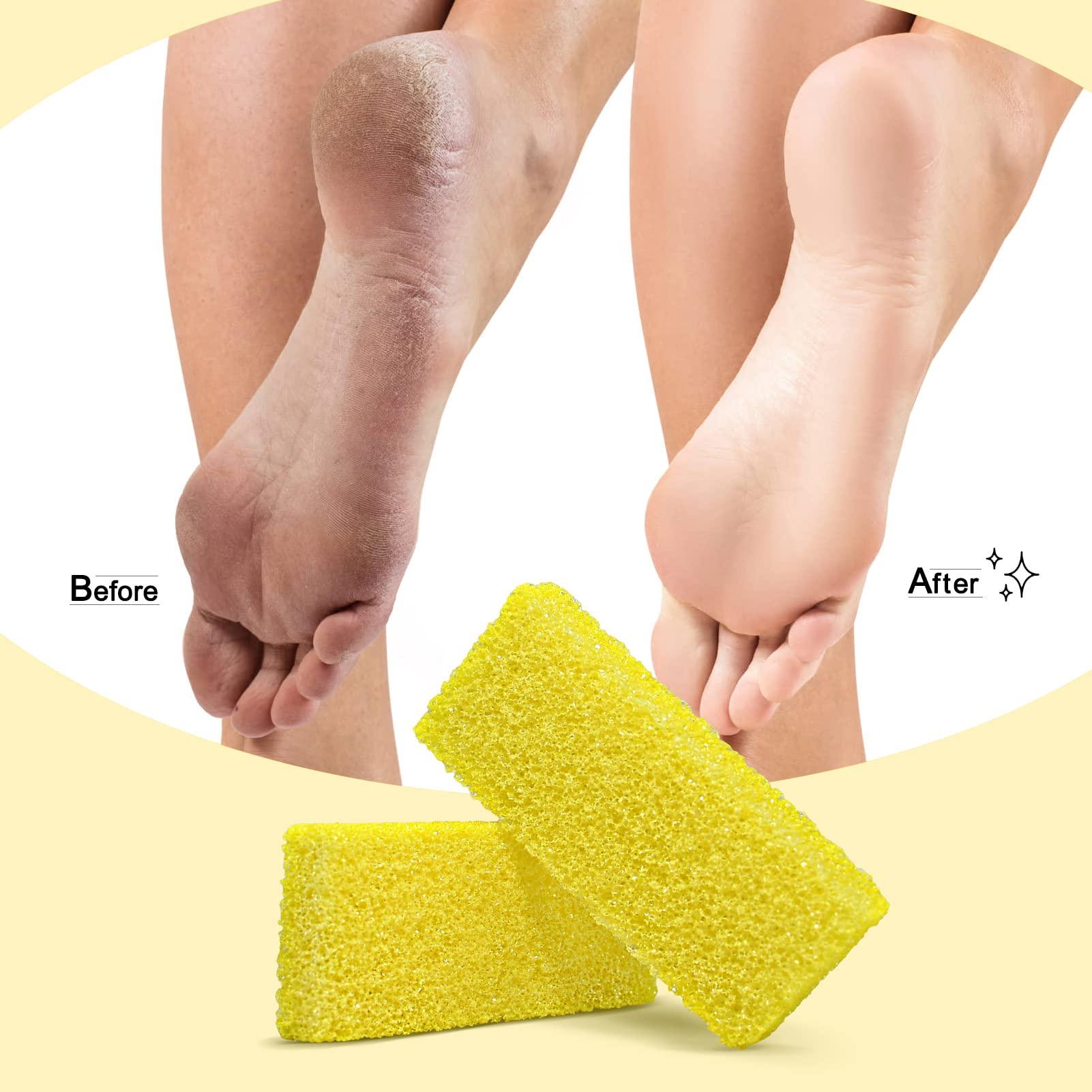 SALVMARY Disposable Foot Scrubber Sponge Pads Pedicure Pumice Stone for Feet Callus Remover Medium Coarse Yellow 40Pcs