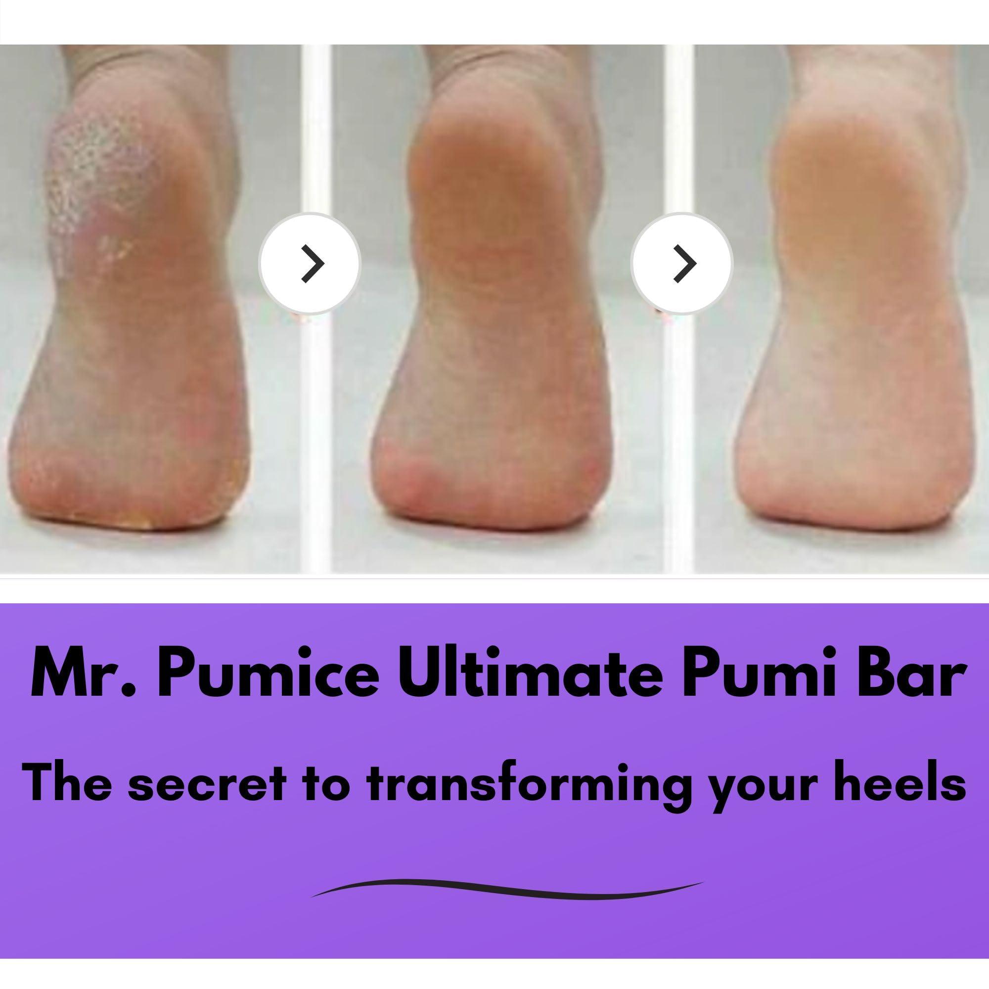 Mr. Pumice Mr. Pumice Ultimate Pumi Bar (4 Pack): 2-in-1 Callus Remover, Pedicure Stone & Ped File Scrubber for Smooth Feet and Heels, Dual-Grit (Medium + Coarse)