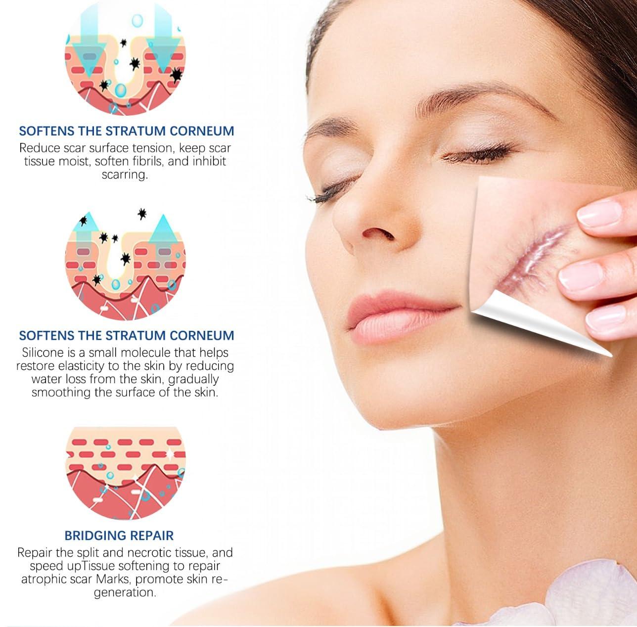 Bioline Bioline Clear Silicon Scar Sheet 4 x 150 Cm for Healing Scars Transparent tear silicone tape roll for hypertrophic scars and keloids caused by surgery, medical silicone for scar removal