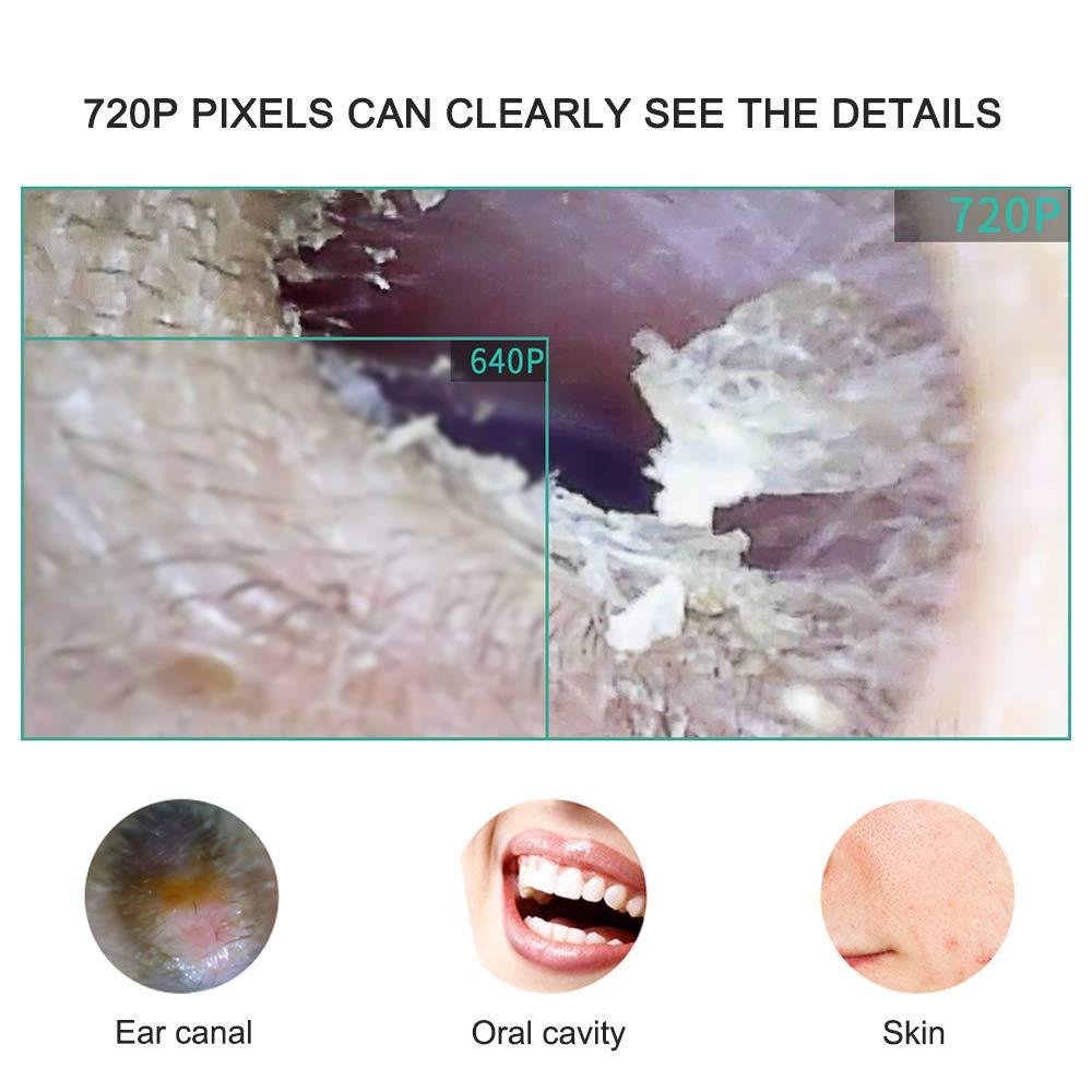 IKTU Iktu Otoscope Ear Cleaner USB Endoscope, 720P HD Visual Ear Spoon Digital Ear Camera, 3 in 1 Borescope Inspection Earwax Removal Cleaning Tool with 6 LED Lights for Android,Windows,MAC,Tablet