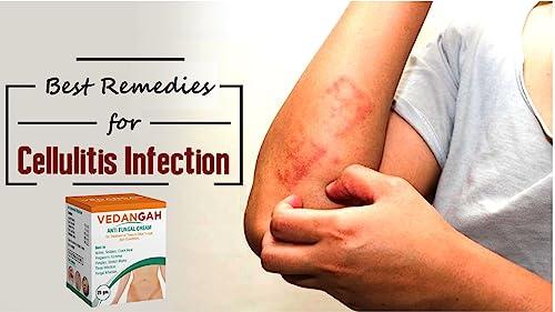 VEDANGAH VEDANGAH Anti Fungal Cream | Anti-Itching Skin Cream | Eczema | Psoriasis | Ringworm Cream 12Gm Pack Of 2