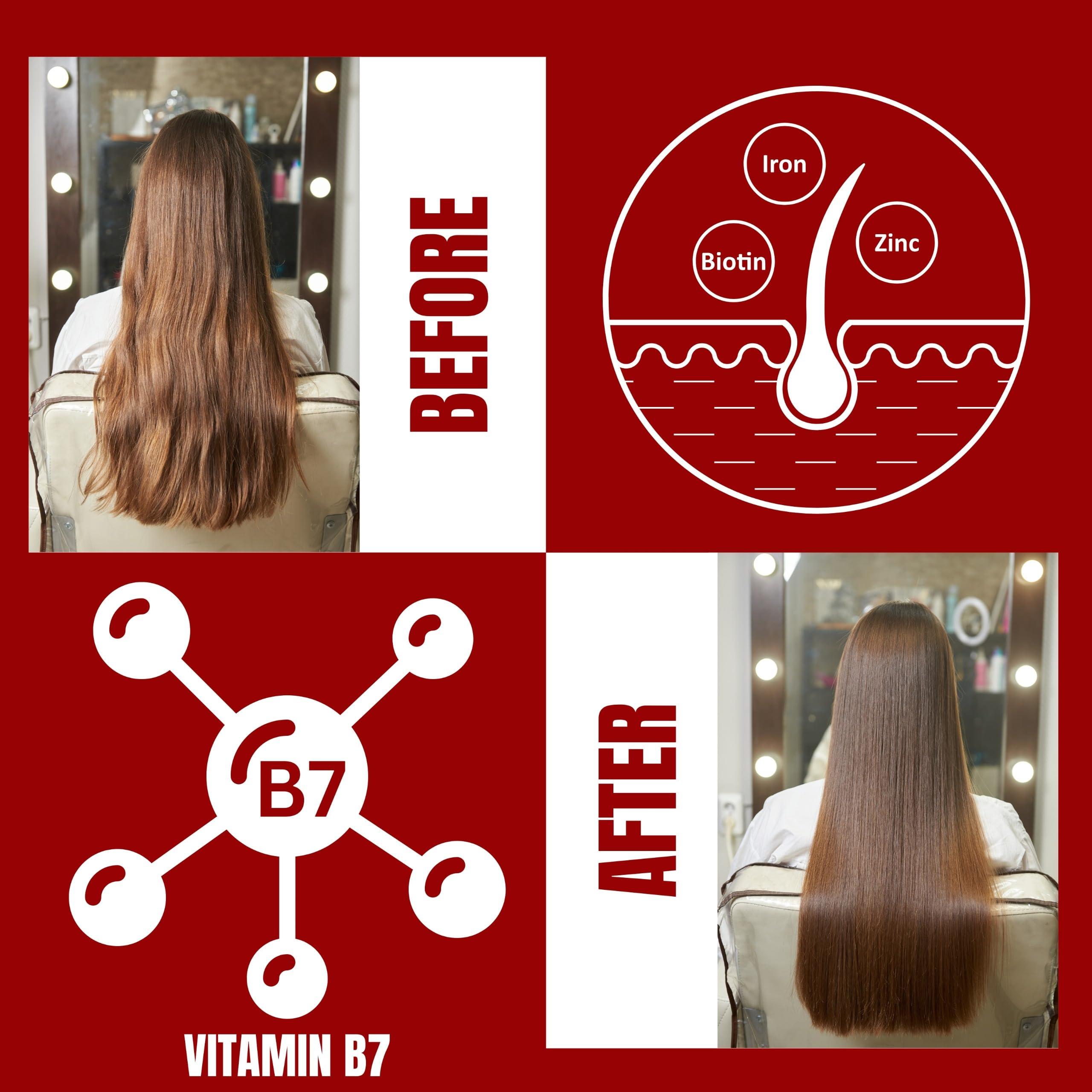 XPEL XPEL BIOTIN & COLLAGEN THICKENING SHAMPOO & CONDITIONER for Women & Men, Anti Hair Fall, with Vitamin B7 & Hydrolyzed Wheat Protein, Promotes Hair Growth & Prevents Hair Fall, All Hair Types 800 ml