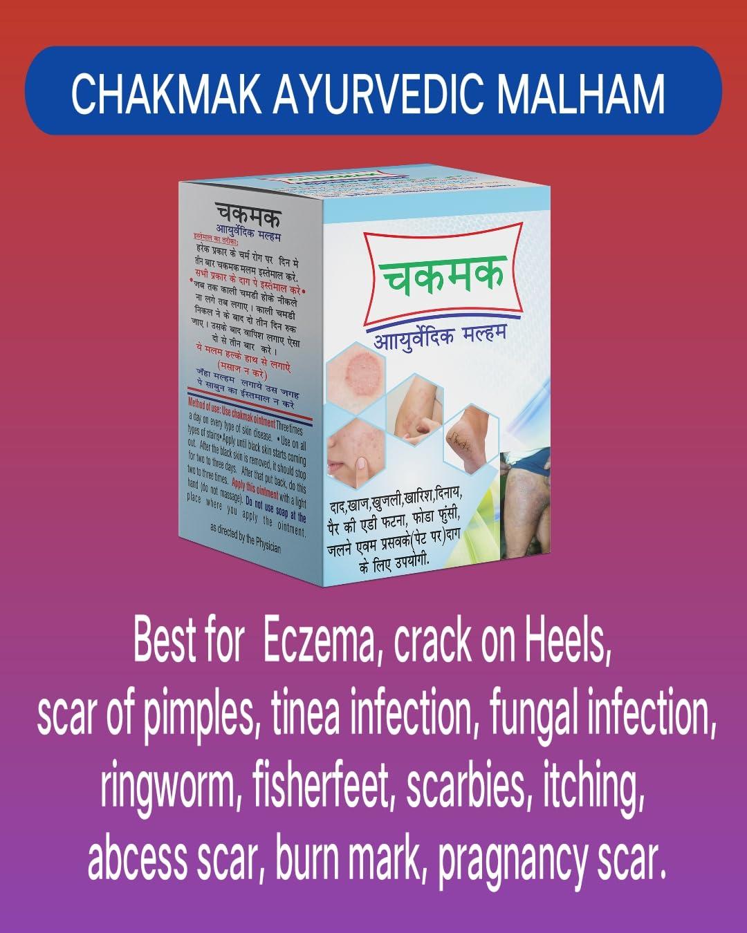 Parasmani Chakmak Ayurvedic Ontment 20gm (pack of 2)
