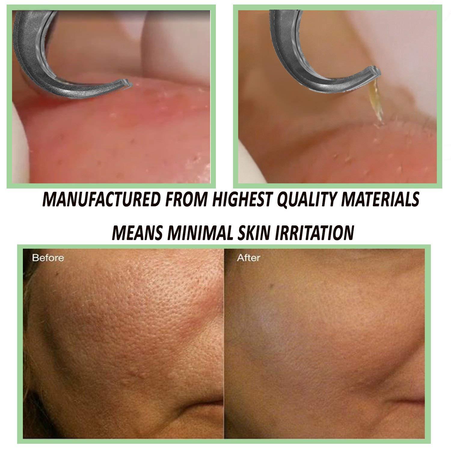 FEITA Blackhead Acne Extraction Tweezers - FEITA Pro & Surgical-Grade Stainless Steel Bend Curved Comedone Extractor Tweezer Tool for Remove Whitehead and Clogged Pores, Pimple - Pink