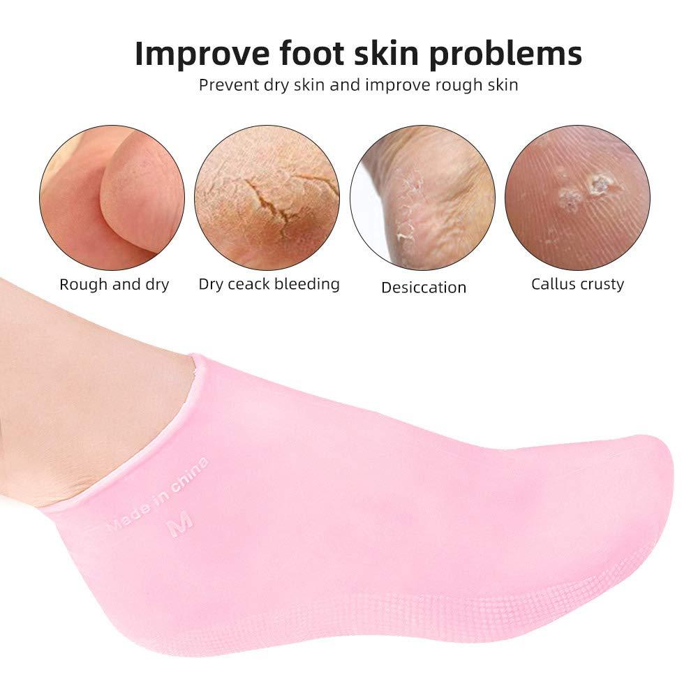 N+A Moisturizing Gloves&Socks, Silicone Gel Gloves for Dry Skin, Cracked Hands and Foot, Full Finger Waterproof Gloves for Hands Foot Care SPA (Pink, Socks)