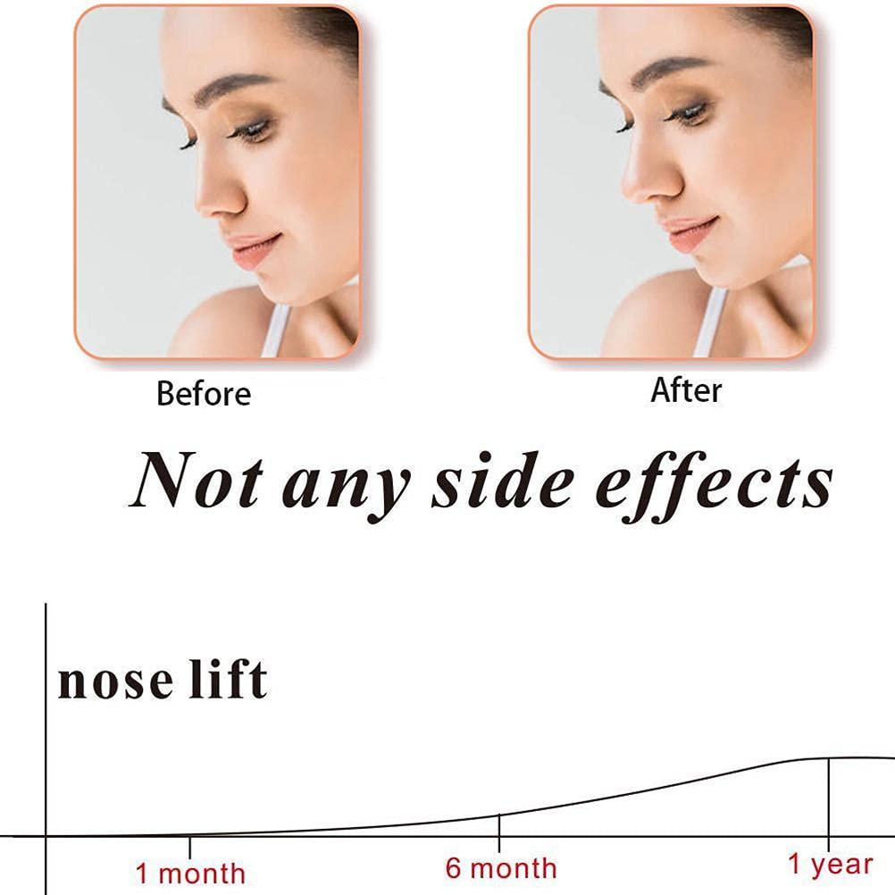 Shiker Shiker Women Silicone Hand Powered Nose Shaper Clip, Nose Corrector Device Nose Bridge Straightener Corrector, Soft Safety Nose Up Lifting Without Surgery Beauty Tool