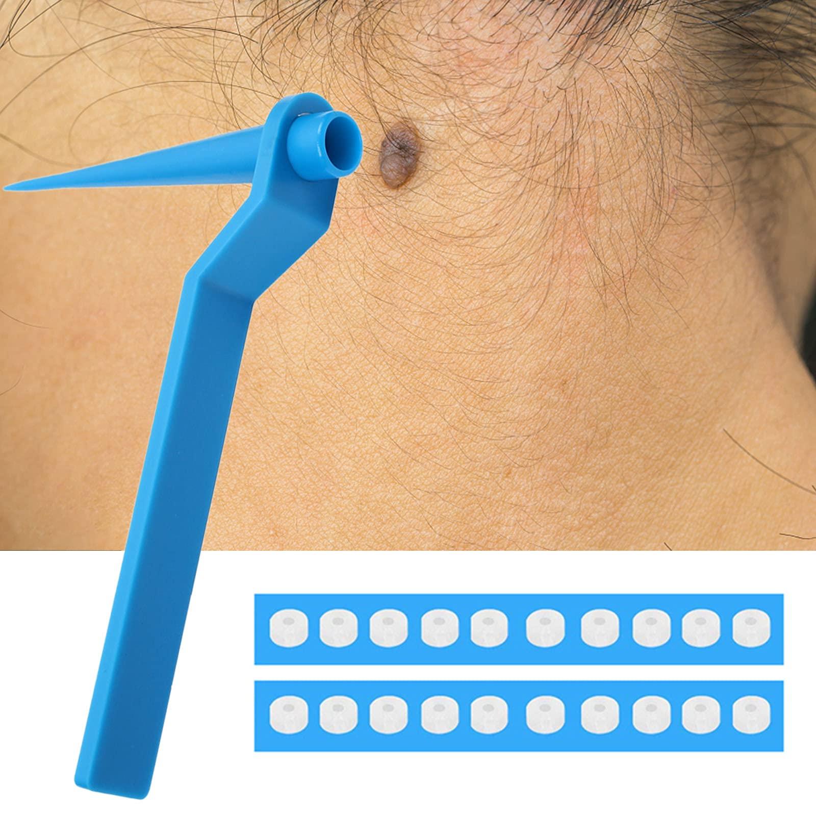 RYAP Skin Tag r Set Skin Tag Removal Kit with Skin Tag Removal Rubber Bands for Removing Medium to Large (4mm to 8mm) Sized Skin Tags Painlessly