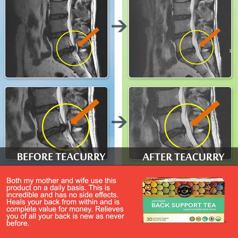 TEACURRY TEACURRY Back Pain Tea (100 Grams, 50 Cups) - Helps with Back Pain, Sciatica, Herniated Disc-Tea For Bones