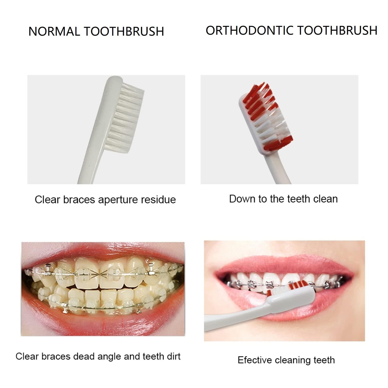 YOUYA DENTAL Boxed Portable Orthodontic Care Kit Orthodontic Toothbrush Kit for Braces for Orthodontic Patient Travel Oral Care Kit Dental Travel Kit Interdental Brush Dental Wax Dental Floss (8 Pcs/Pack)-Red