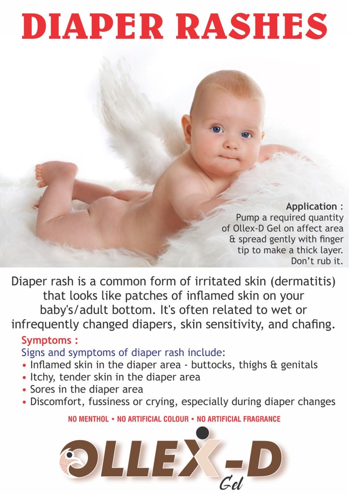 OLLEX-D OLLEX-D Skin Rash Relief Gel - Fast-Acting Soothing Formula for Itching and Redness - Natural Ingredients - Dermatologist Approved - 50ml Pack (5)