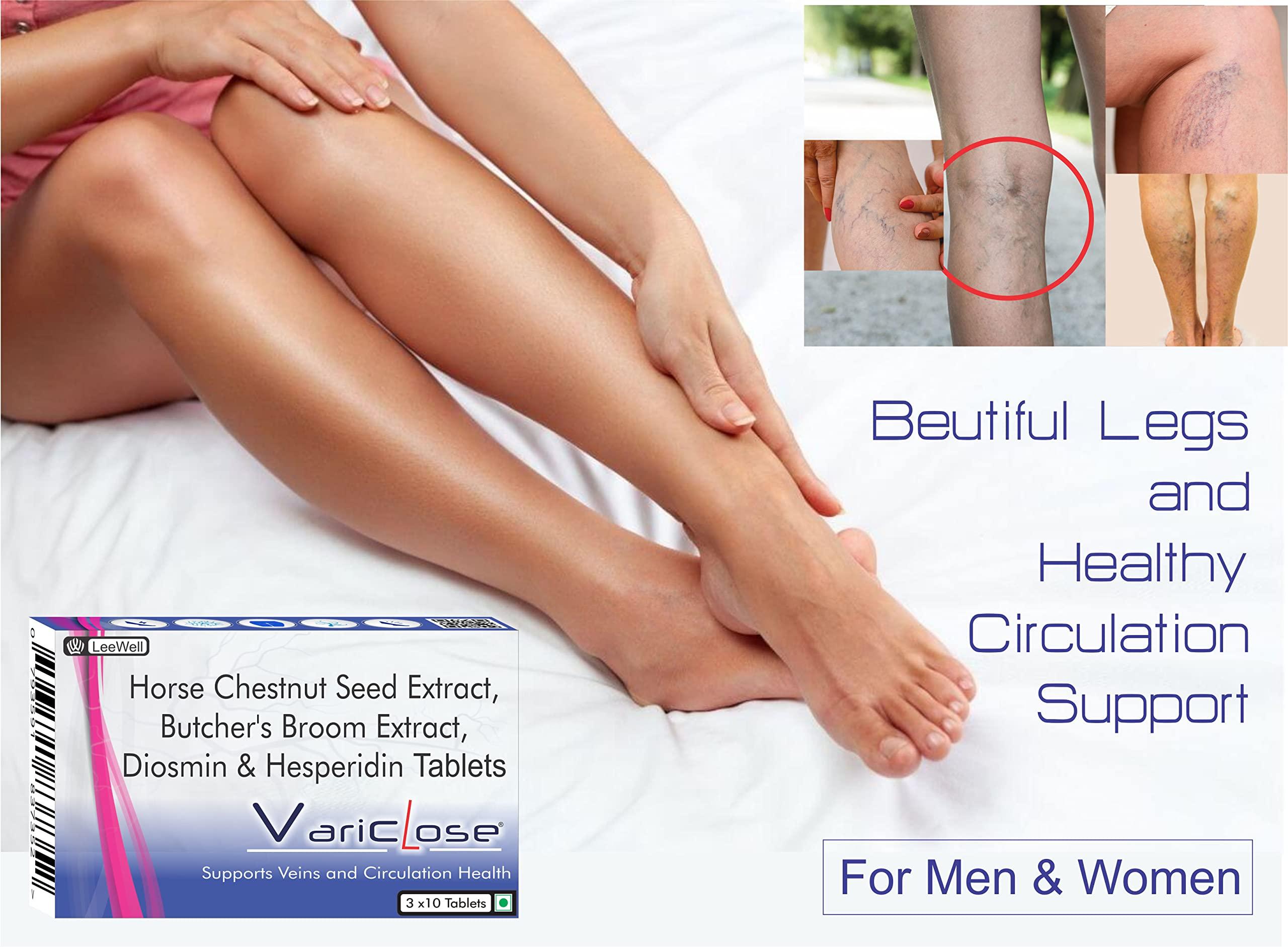 VARICLOSE Variclose Varicose Vein Support | Restless Legs Circulation Flow, Cramps, Twisted, Enlarged, Discolored Veins Aid | Diosmin, Hesperidin, Horse Chestnut extract (Aescin), Butcher\'s broom extract (Ruscogenins) - 30 Tablets (Leewell Pharma)