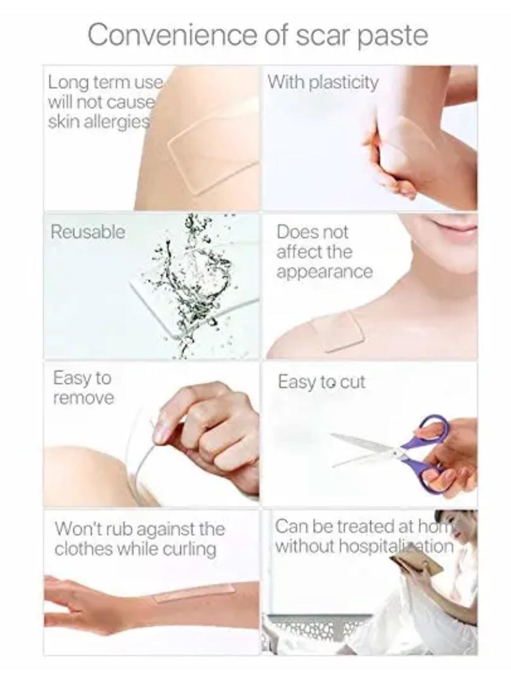 Bioline Bioline Clear Silicon Scar Sheet 4 x 150 Cm for Healing Scars Transparent tear silicone tape roll for hypertrophic scars and keloids caused by surgery, medical silicone for scar removal