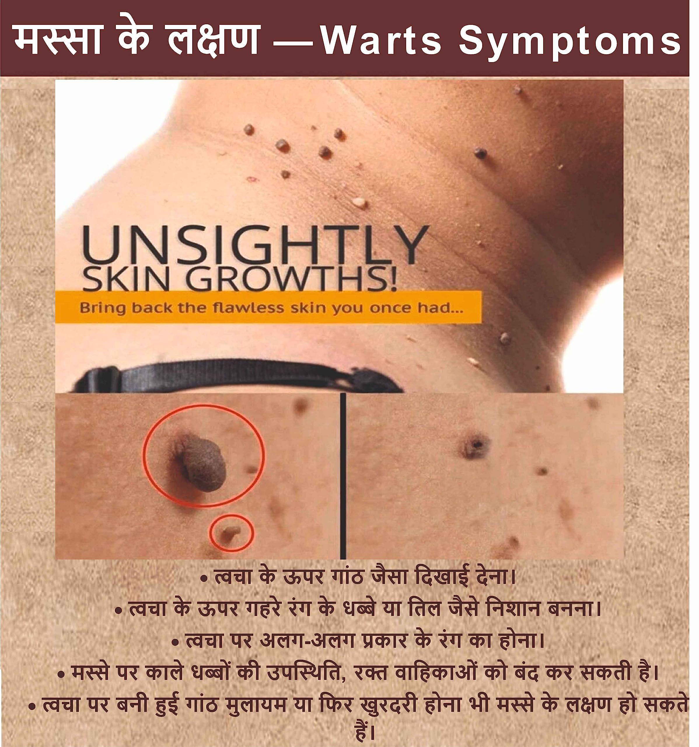 Gunmala Herbals Gunmala Herbal Massa Mukti Lotion - 20 Ml. (Ayurvedic Skin Tag Remover)