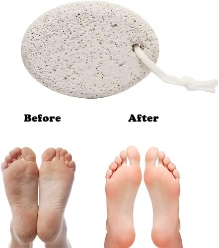 Oblivion Oblivion Personal Care Oval Shape Pumice Stone Scrubber for Body and Foot White Pack of 2
