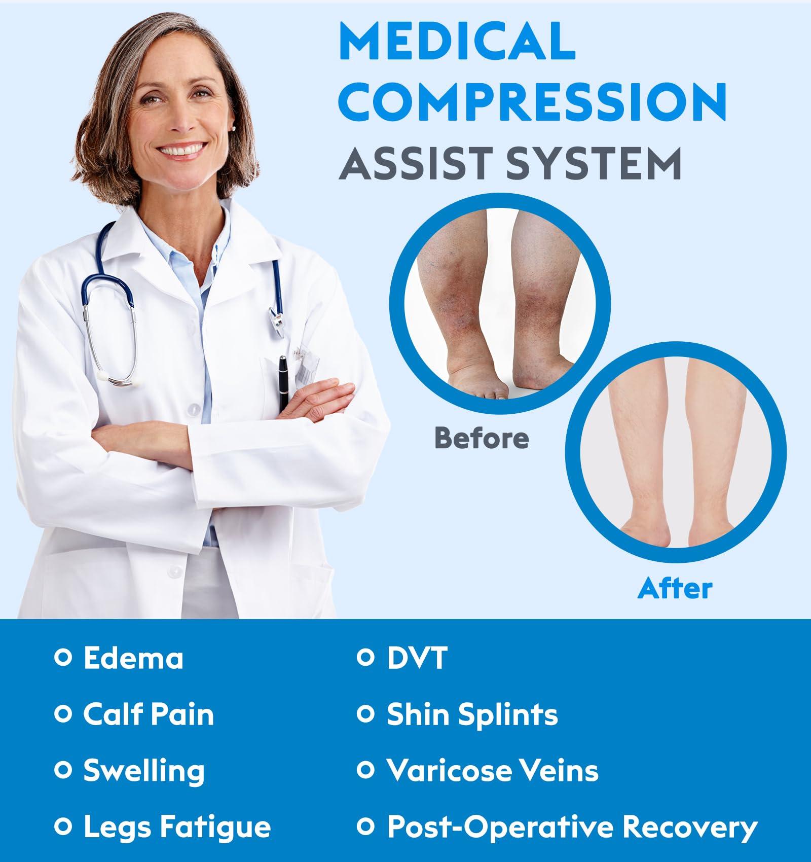 MGANG Compression Socks, Open Toe, 15-20 mmHg Graduated Compression Stockings for Men Women, Knee High Compression Sleeves for DVT, Maternity, Pregnancy, Varicose Veins, Relief Shin Splints, Beige XXL