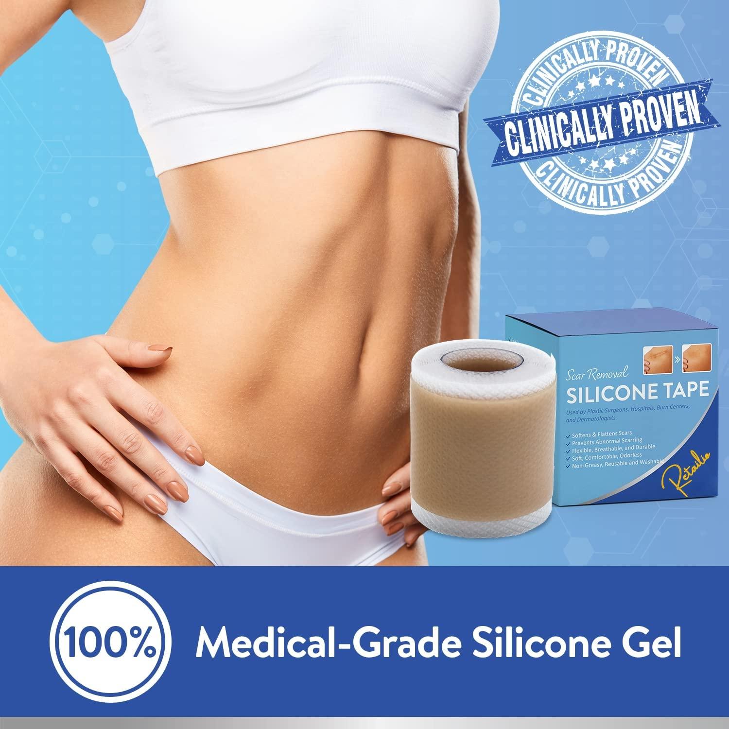Retailio Retailio Silicone Scar Sheets Silicone Scar Tape 1.6x60" for Softening and Flattening Scars, C-Section, Keloid Surgery, Painless Removal, Reusable, Washable