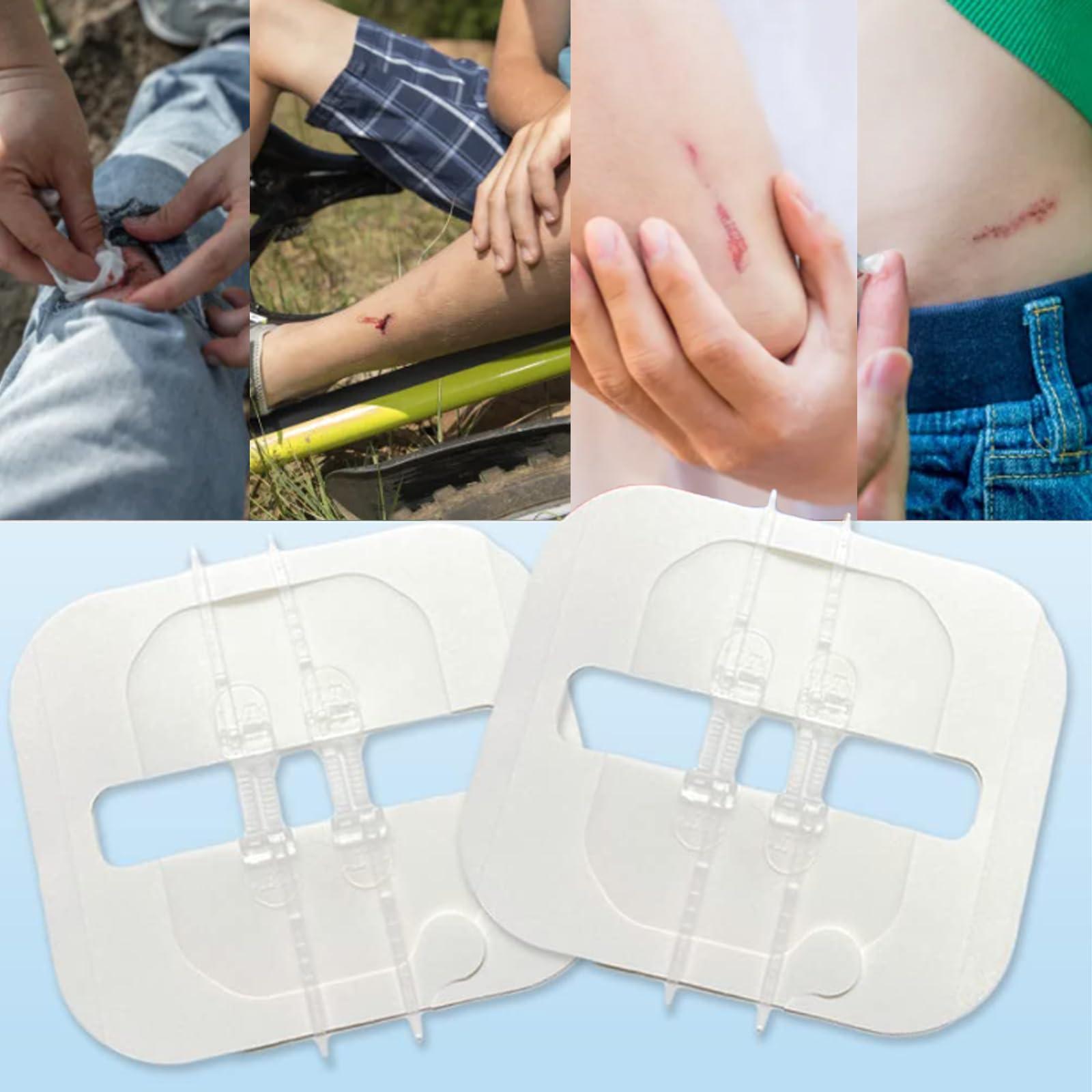 Mediss Mediss Emergency Wound Closures Band-Aid Adhesive Bandages, Zip Stitch Stickers For Camping, Survival & Household Gear, 2 Pcs/Box