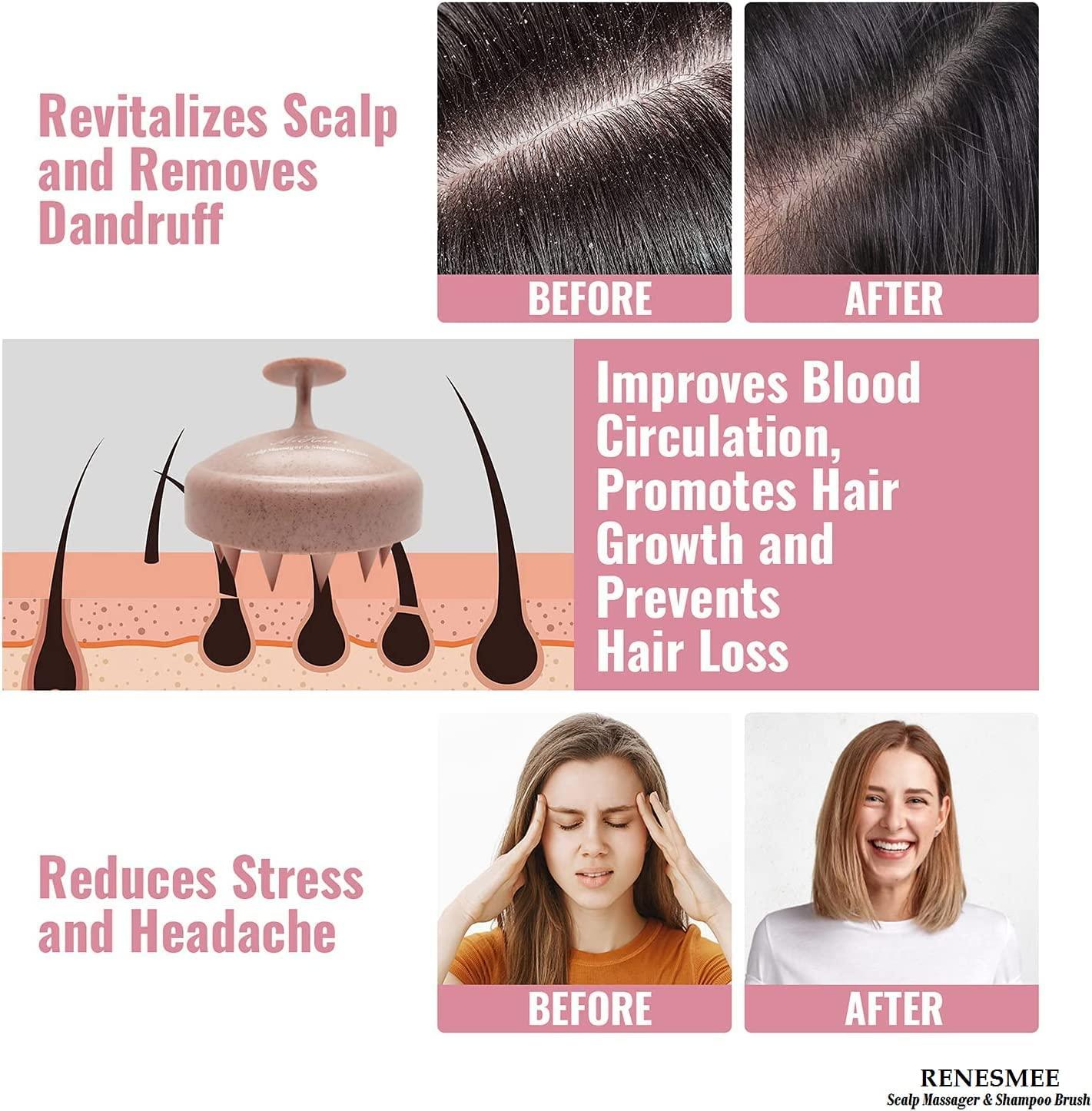 JustLatest Scalp Massage, Scalp Massager (Marble Pink), Head Massager, Scalp Massager For Hair Growth, Hair Massager, Hair Massager For Hair Growth, Hair Scalp Massager