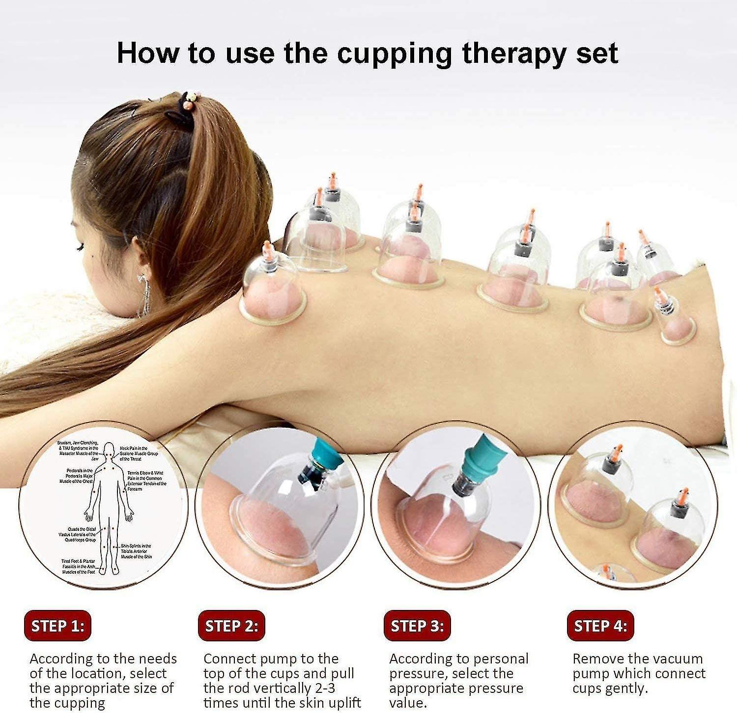 ANCS ANCS Acupressure 24 Vacuum Cups Chinese Medicine Magnet Therapy Cupping Set Acupuncture Manual Massager for Pain Relief Multicolor