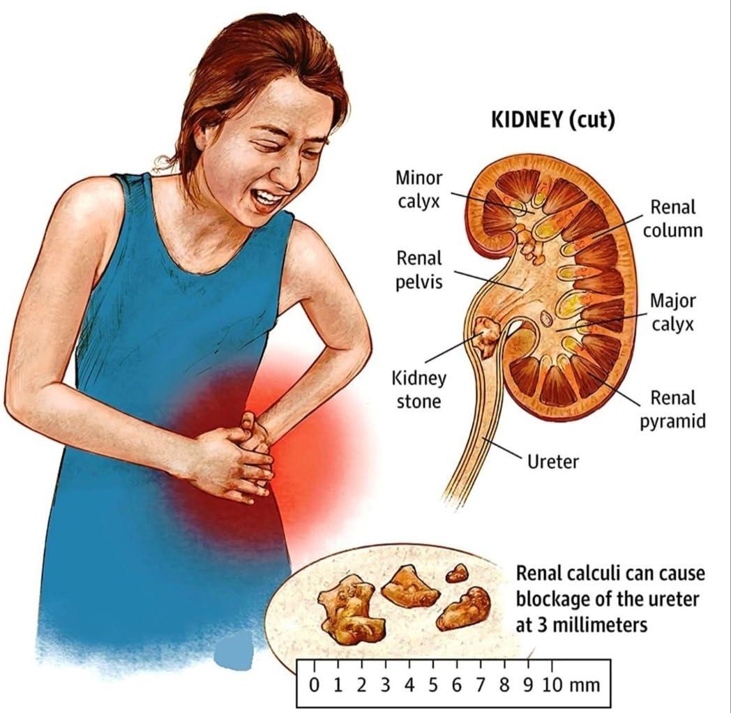 KEVA Keva Stone Crush (Asmari Syrup) Tonic (200x2=400ml)