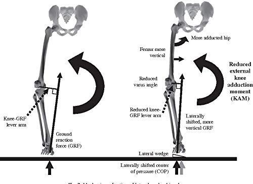 SHIVSAKTI 1 Pair (1 for right leg + 1 for Left leg) Lateral Wedge for genu varum and medial knee osteoarthritis correction (small)