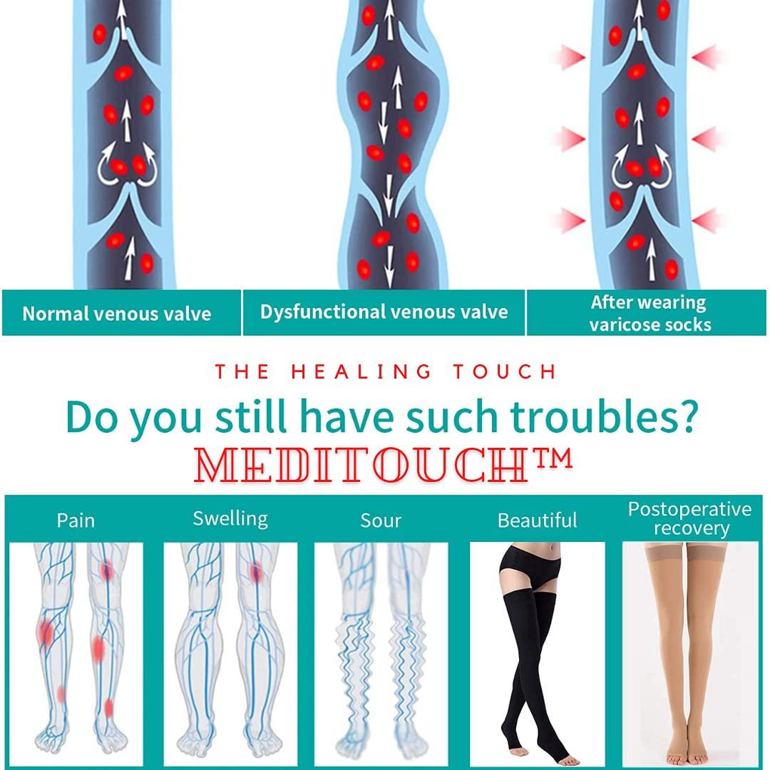 Meditouch MediTouch™ Varicose veins Stockings for Women Men- Optimum Compression Stocks Improve Circulation Recommended by Dr. for Pain relief -Open Toe- Pair (THIGH LENGTH, Small)