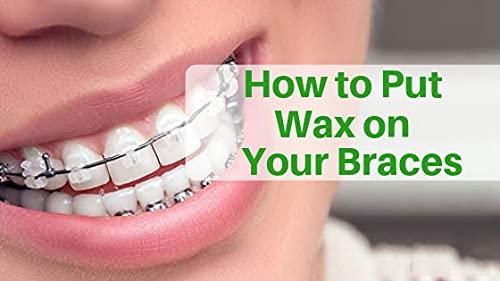 Dentosmile Dentosmile Orthodontic Wax for Braces/Patient Relief Wax - 5 Strips Per Box