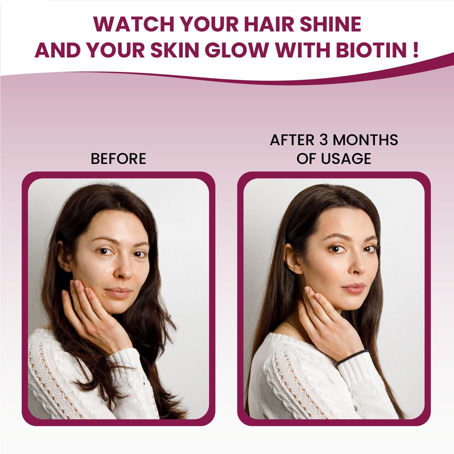 HIMALAYAN ORGANICS Himalayan Organics Biotin - Hair & Skin Gummies For Men and Women - 60 Gummies