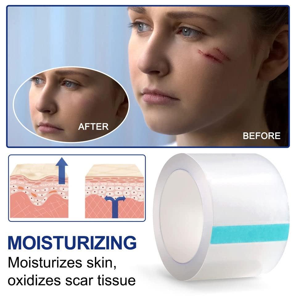 BOXANIA Boxania® Clear Silicone Scar Sheets, Silicon gel sheets for Scars Transparent Medical Silicone Gel Tape for Scar Removal, Silicone Scar Tape Roll For Hypertrophic Scars and Keloids Caused by Surgery
