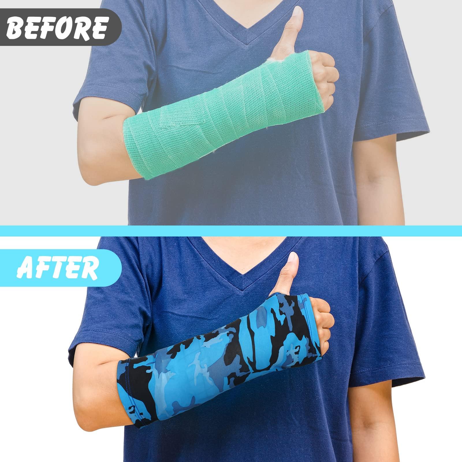 Boao 6 Pack Arm Cast Cover Elastic Cast Sleeve Arm Decorative Cast Cover Removable Washable Arm Cast Protector