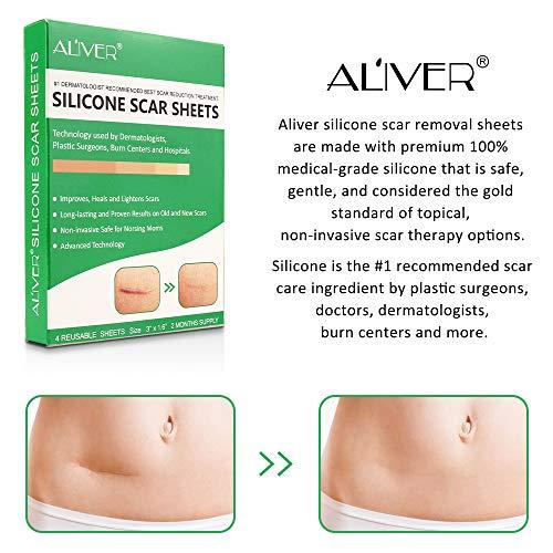 Purvigor Reusable Silicone Scar Removal Sheets, Professional Silicone Scar Sheets, for Scars Caused by C-Section, Surgery, Burn, Injuries, Acnes and Stretch Marks, Works on Old & New Scars, 4 Sheets