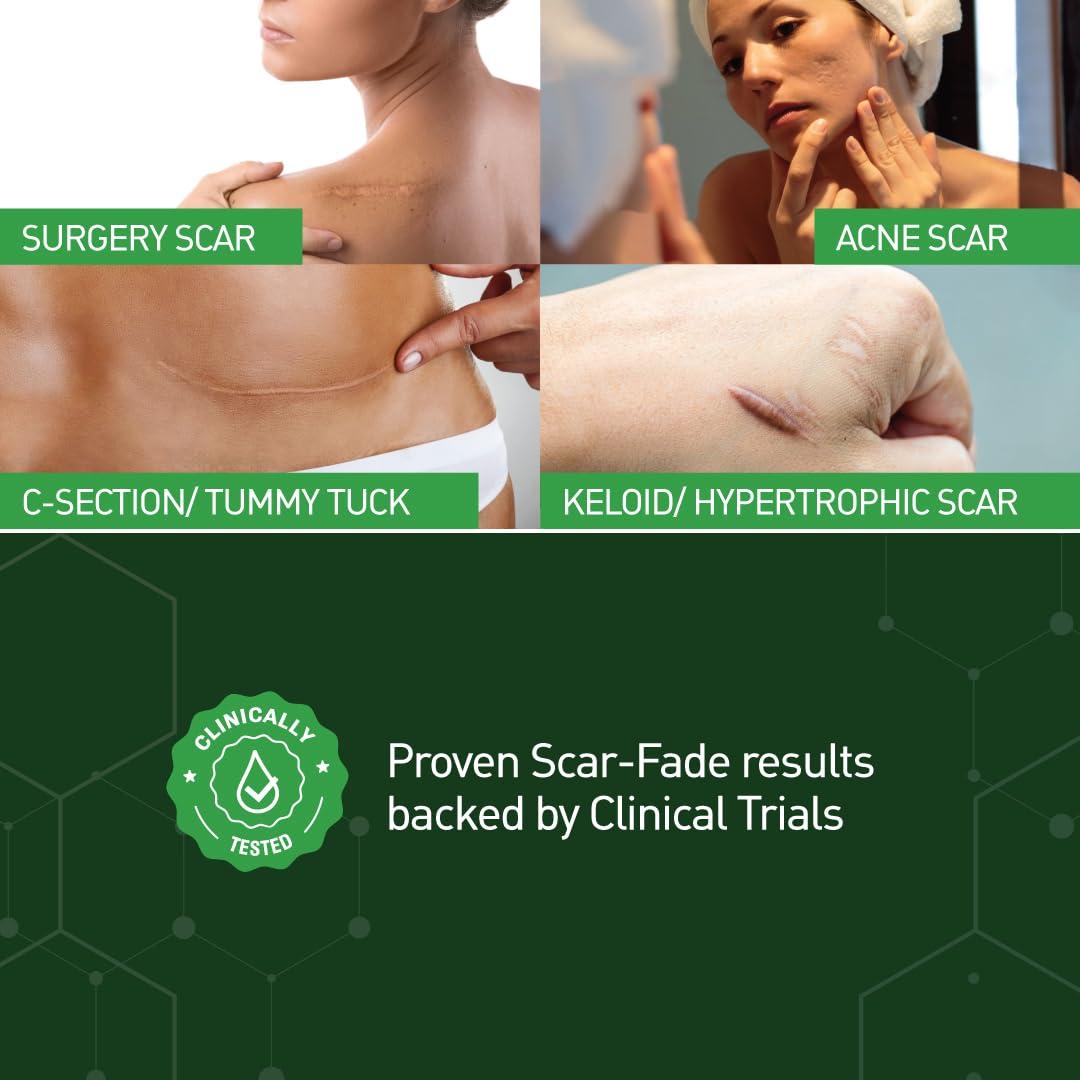 Mepiform Mepiform Resizable Scar Removal Silicone Gel Sheet Tape, upto 14 days or more pack, small scar heal patches for Keloid, C Section, Tummy, Acne scars, Surgery, Burns, alike Scar Cream Gel, 5x7.5 cm