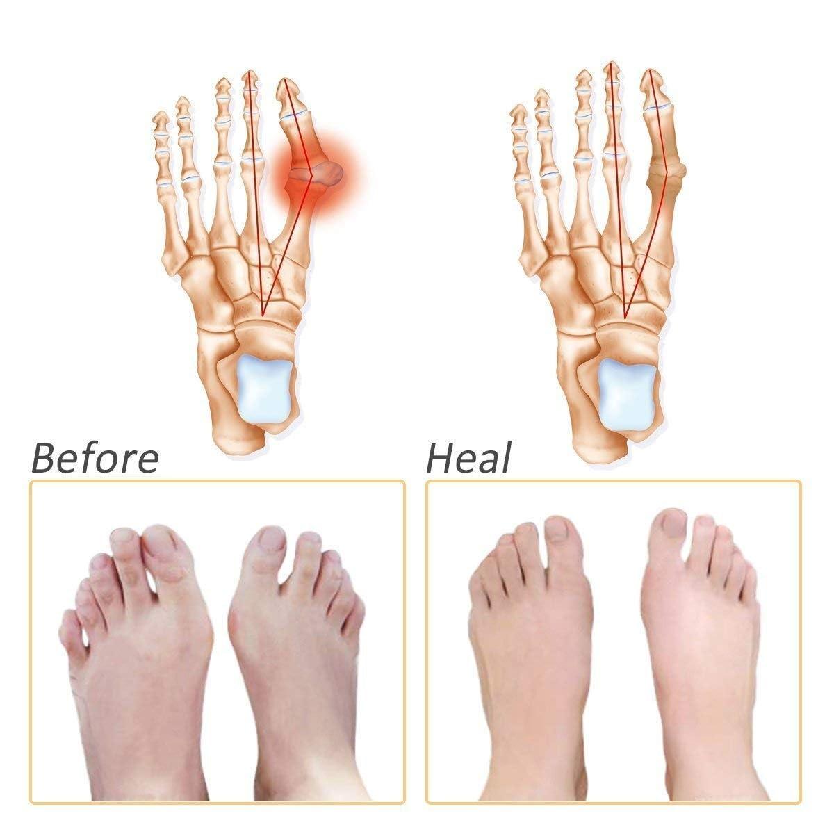 JAZZY PEARLS JAZZY PEARLS 1 Box Eyeglass Sun Glasses Screw Nut Nose Pad Screwdriver Repair Tool Assorted Kit