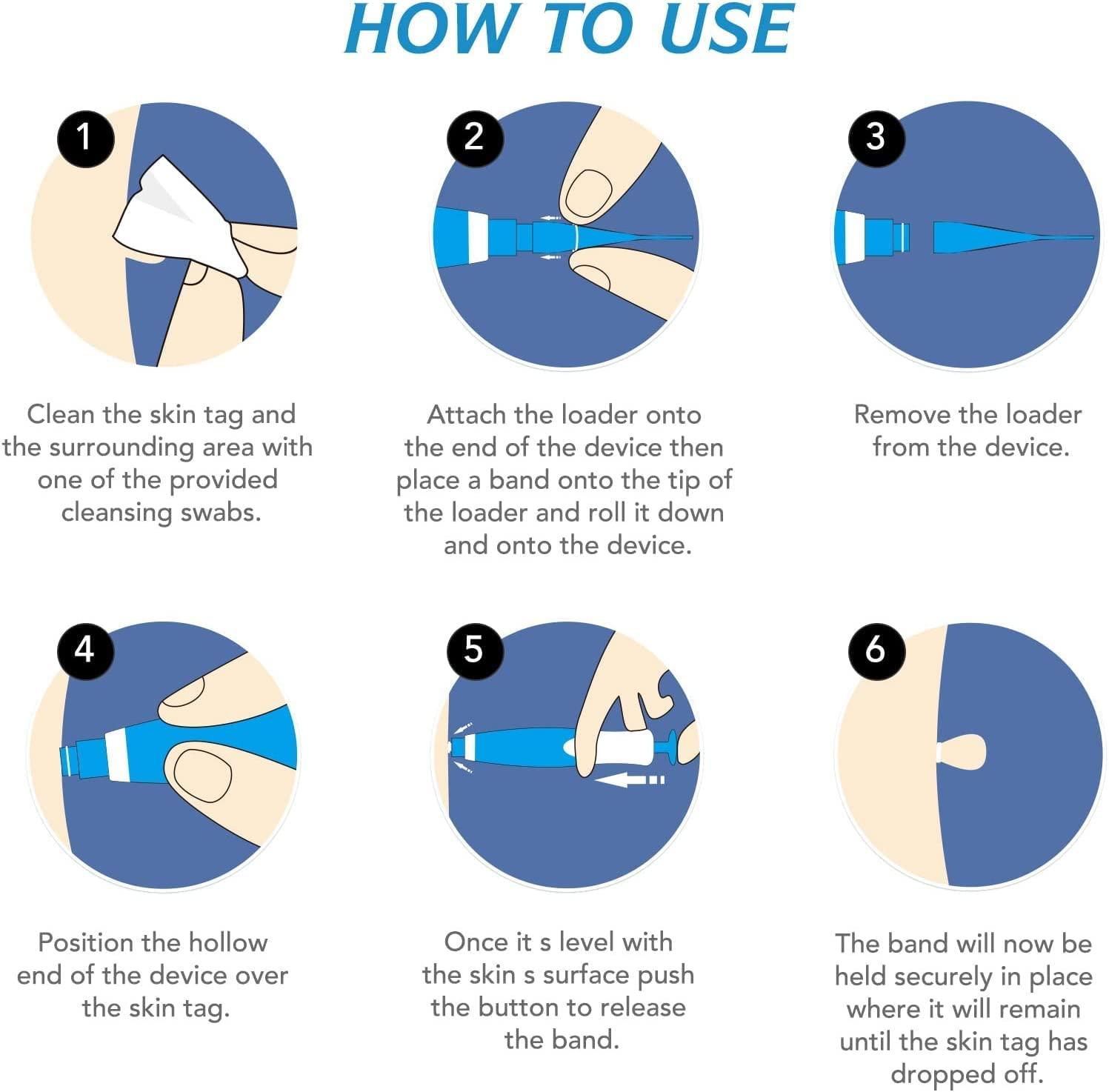 ISTARA Istara Painless Skin Tag Remover Kit 2 in 1 Skin Tag Removal with Auto Skin Tag Remover Pen with 20 Micro and 20 Regular Skin Tag Bands, Safe and Painless Remove 2mm - 8mm Skin Tags (1Pcs)