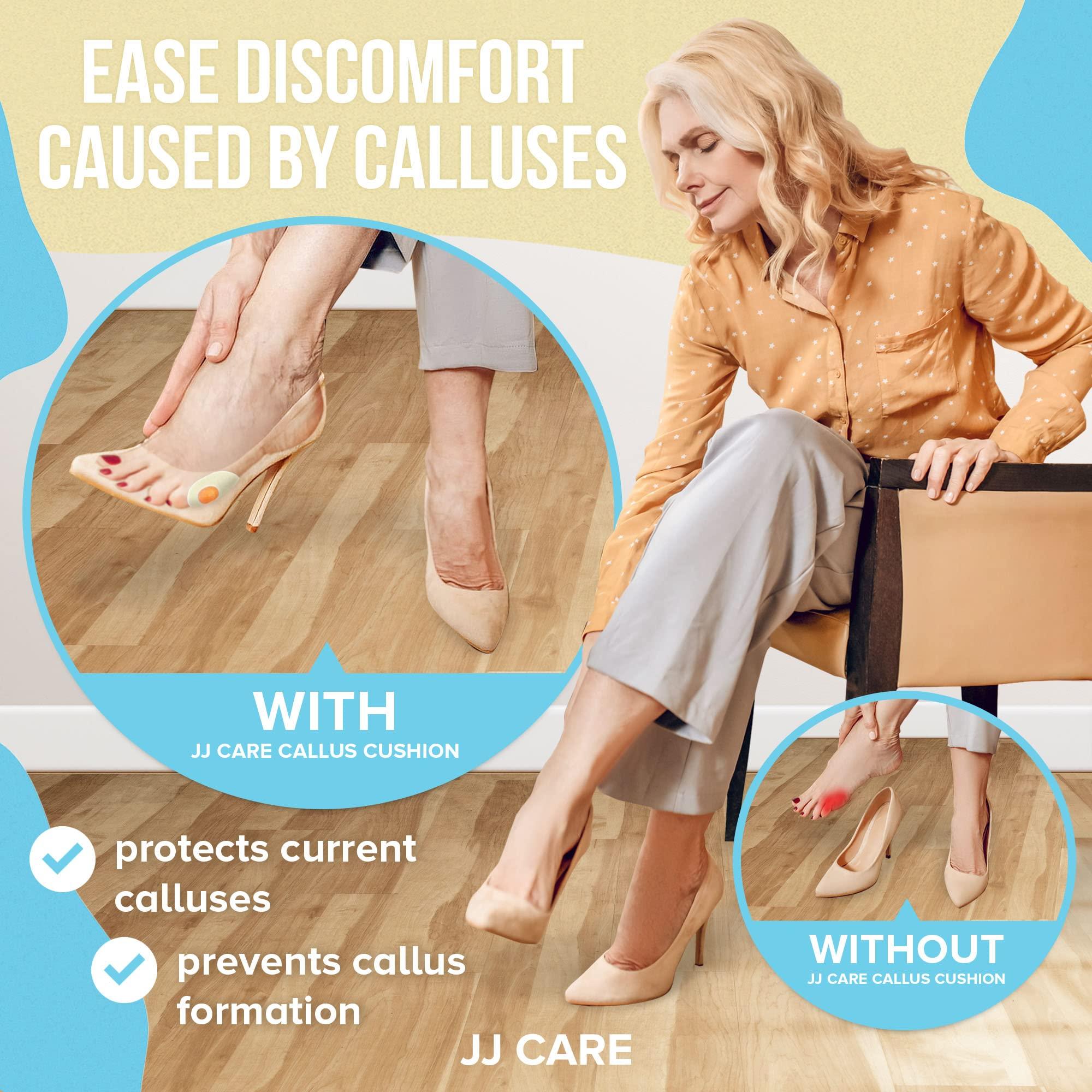 JJ CARE [Box of 50] Callus Cushions, Oval Callus Pads for Feet, Soft Felt Callus Pads for Pain Relief & Foot Care, Self-Adhesive Foot Callous Cushions, Medical Grade Callous Protector