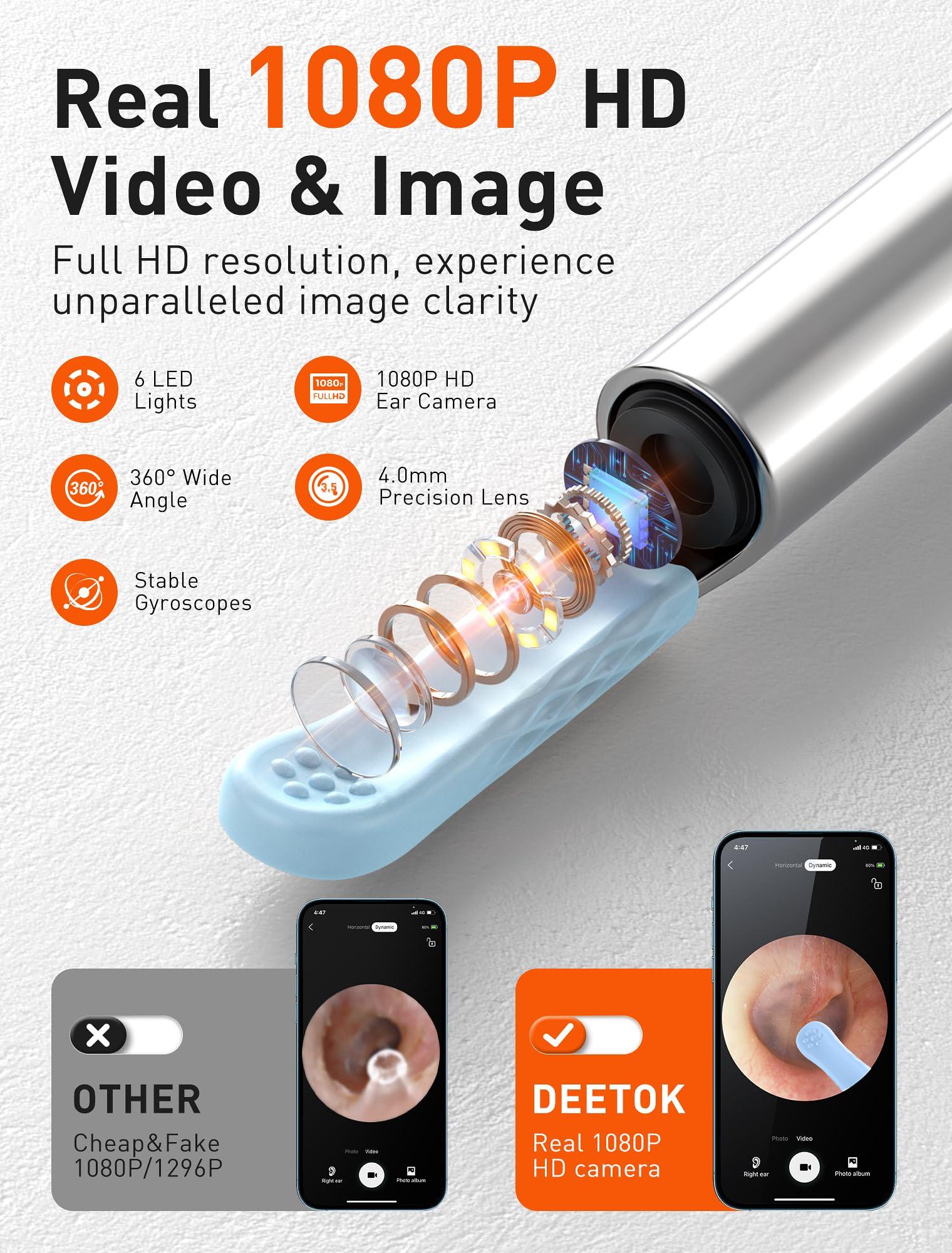 DEETOK Ear Wax Removal, Ear Cleaner with Camera, Ear Wax Removal Kit with 1080P, Ear Camera Otoscope with Light, Ear Cleaning Kit with Cap for iPhone, iPad, Android Phones (Grey)