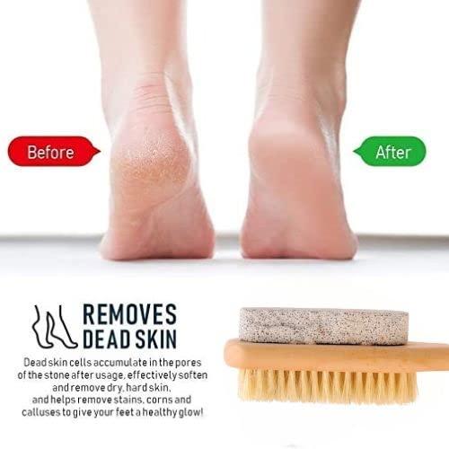 Being One Pumice Stone for Feet with Handle - Corn and Callus Remover, Exfoliator & Scrubber for Dead + Dry Skin on Feet and Pumice Stone for Hands - Corn Removers for Feet (M, 3)