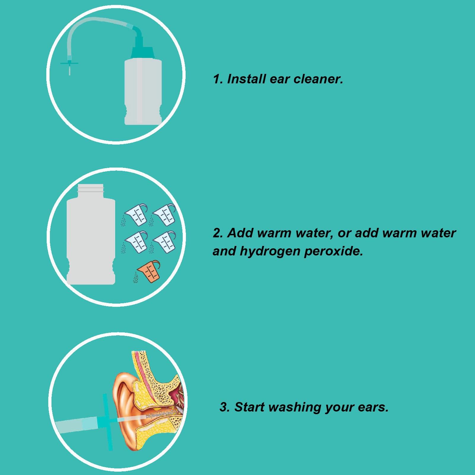 Curlin Ear Irrigation Cleaning Kit, Gentle Clean Safe Avoid Eardrum Problem Ear Wax Irrigation Washer for Adults for Home Use