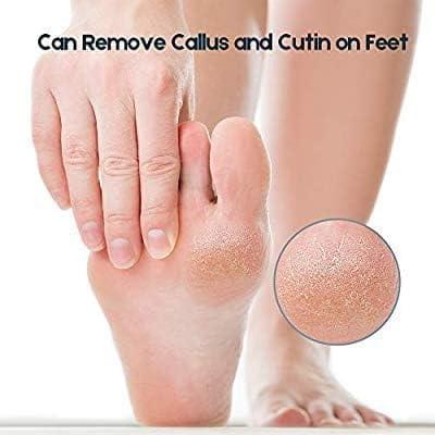 COUNTRY HUB Countryhub Stone Pumice Stone for Feet - Callus Warts Corn Removal - Pedicure Exfoliator for Dry Dead Skin, Heels, Elbows, Hands - Healthy Foot Care Scrubber