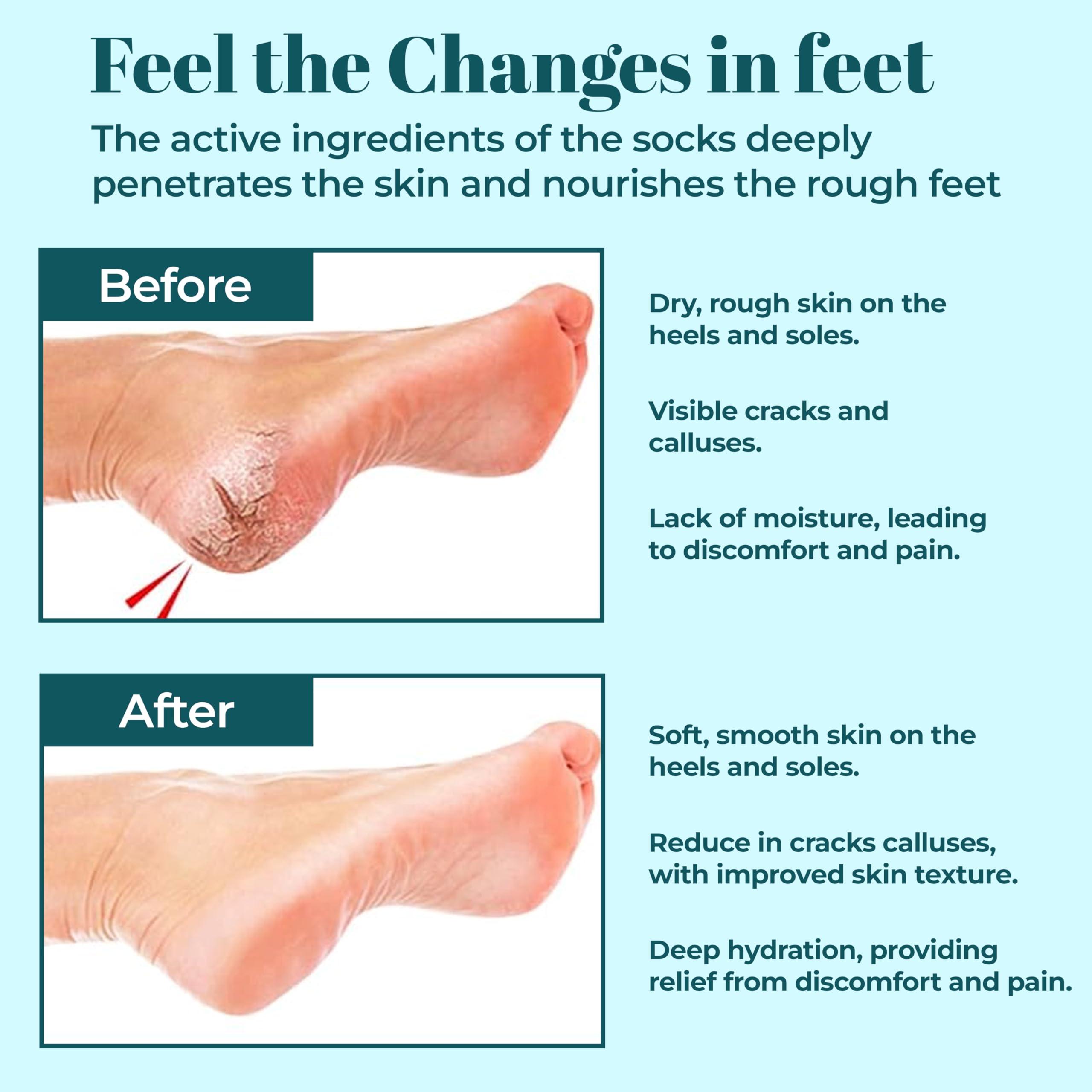 Murti Export Murti Export Moisturizing Silicone Gel Socks (1 Pair) for Men & Women gel socks for dry cracked feet crack heel repair socks foot moisturizer socks Spa Gel Socks Natural Oil & Vitamin E (Multicolor)