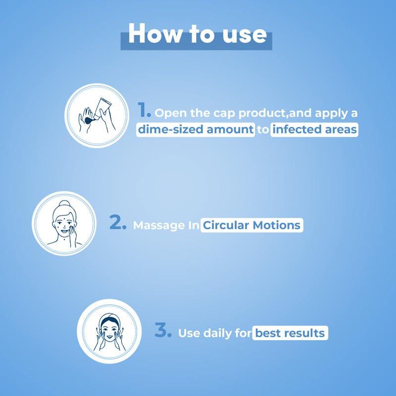 KAILAS JEEVAN Kailas Jeevan Ayurvedic Cream - Natural Relief Cream for Chilblains: Soothes Itching, Swelling, and Irritation 60G (Pack of 1)