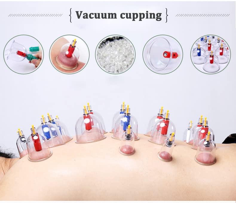 ZCOINS Kangzhu 24-Cup Biomagnetic Chinese Cupping Therapy Set