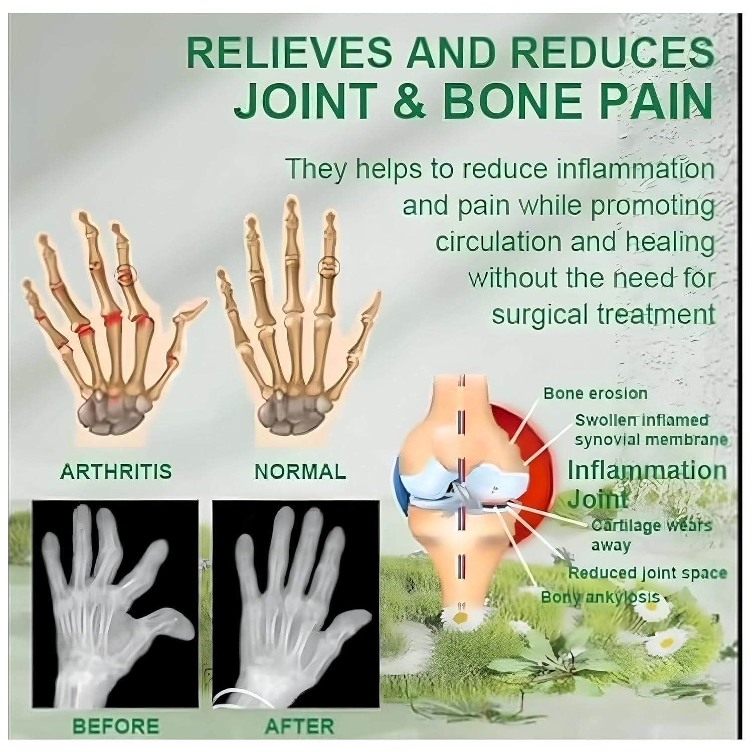 Generic Bee Venom Joint and Bone Therapy Cream | Bee Venom Pain Relief Cream (100g)